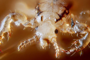 Pediculoza pubiana (genitala) - cauze, simptome si tratament