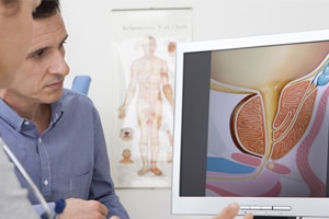 Prostatita - cauze, simptome, diagnostic și tratament