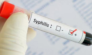 sifilis